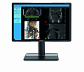 Дентальный томограф NewTom Giano HR Advanced (13x16) - Фото 8